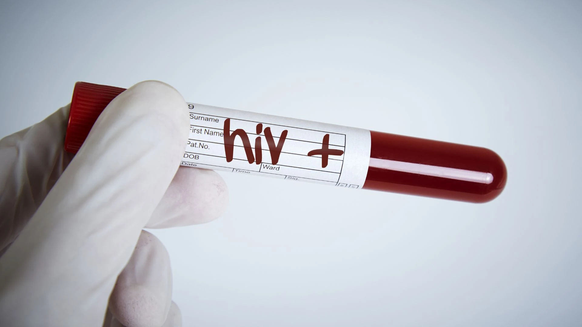 HIV - Aids
