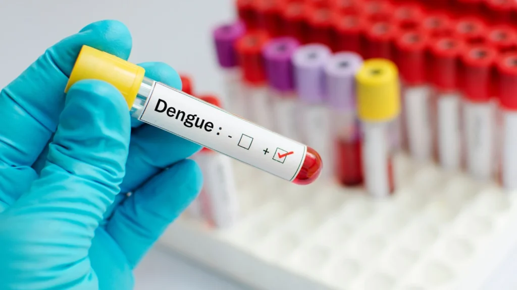 Exame de dengue